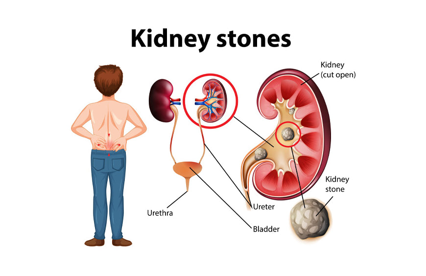 CBD en nierinsufficiëntie: alles wat u moet weten