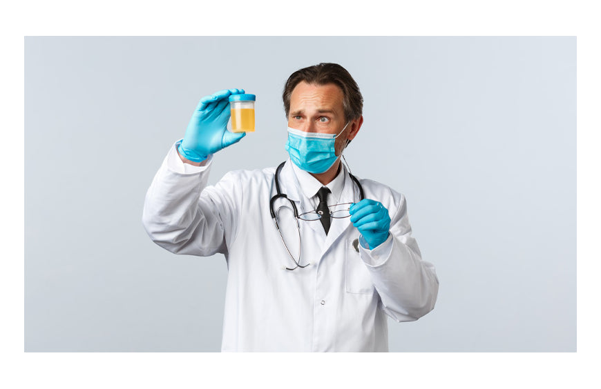 CBD en urinetests: risico op een positief resultaat?